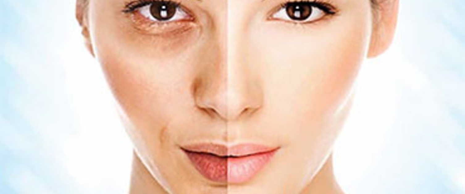 Melasma Treatment & Triggers - Dermatology Associates
